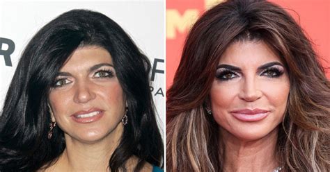 teresa giudice boobs|Teresa Giudice Plastic Surgery Photos: Before and After